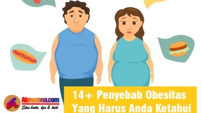 14+ Penyebab Obesitas Yang Harus Anda Ketahui