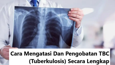 Cara Mengatasi Dan Pengobatan TBC (Tuberkulosis) Secara Lengkap