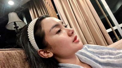 Cita Citata Positif Covid, Manajemen Paksa Tetap Bekerja