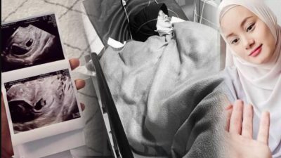 Dinda Hauw Keguguran, Rey Mbayang Sampai Ketemu Di Surga Anaku