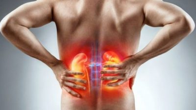 Penyebab Penyakit Ginjal, Hilangkan Kebiasaan Buruk Ini Agar Terhindar